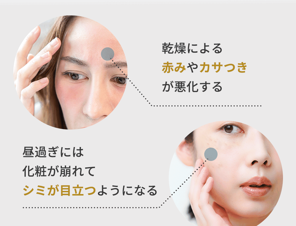 加齢による肌のトラブルの例