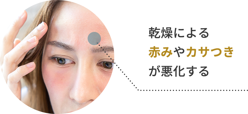 肌に赤みやかさつきがある様子