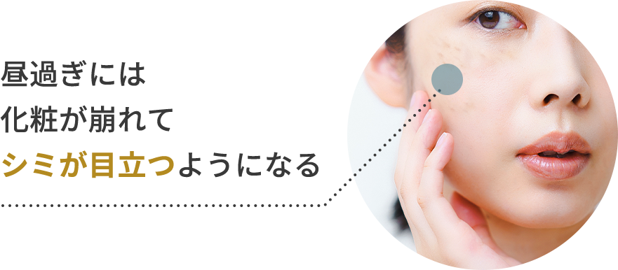 肌にシミがある様子